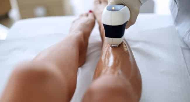 4 motivi per consigliare la depilazione con il laser